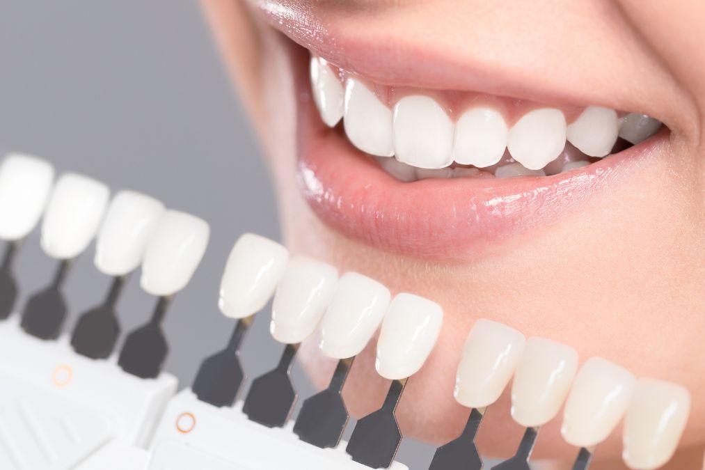 smiling girl with teeth selecting a shade